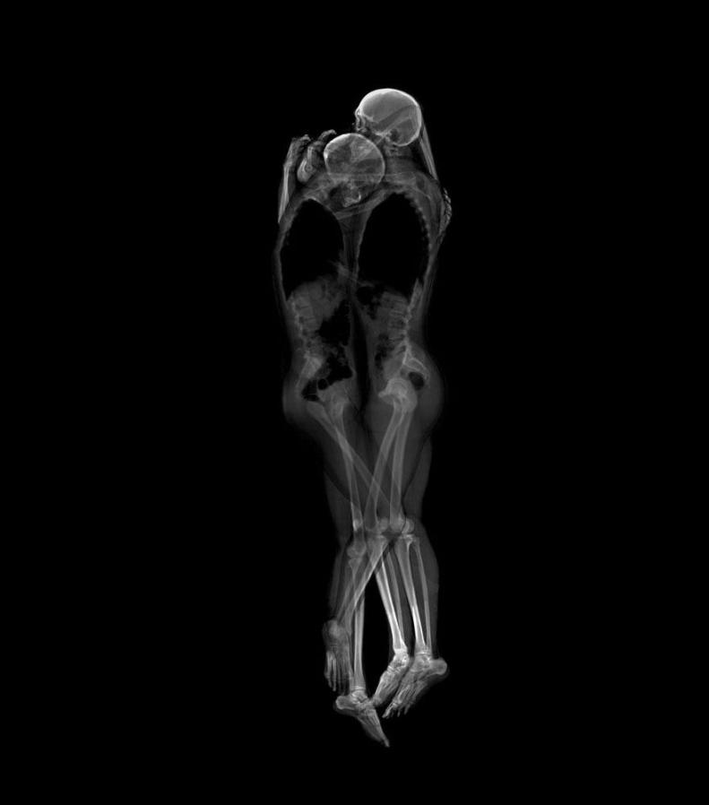x-ray-couple-portraits-ayako-kanda-mayuka-hayashi-1
